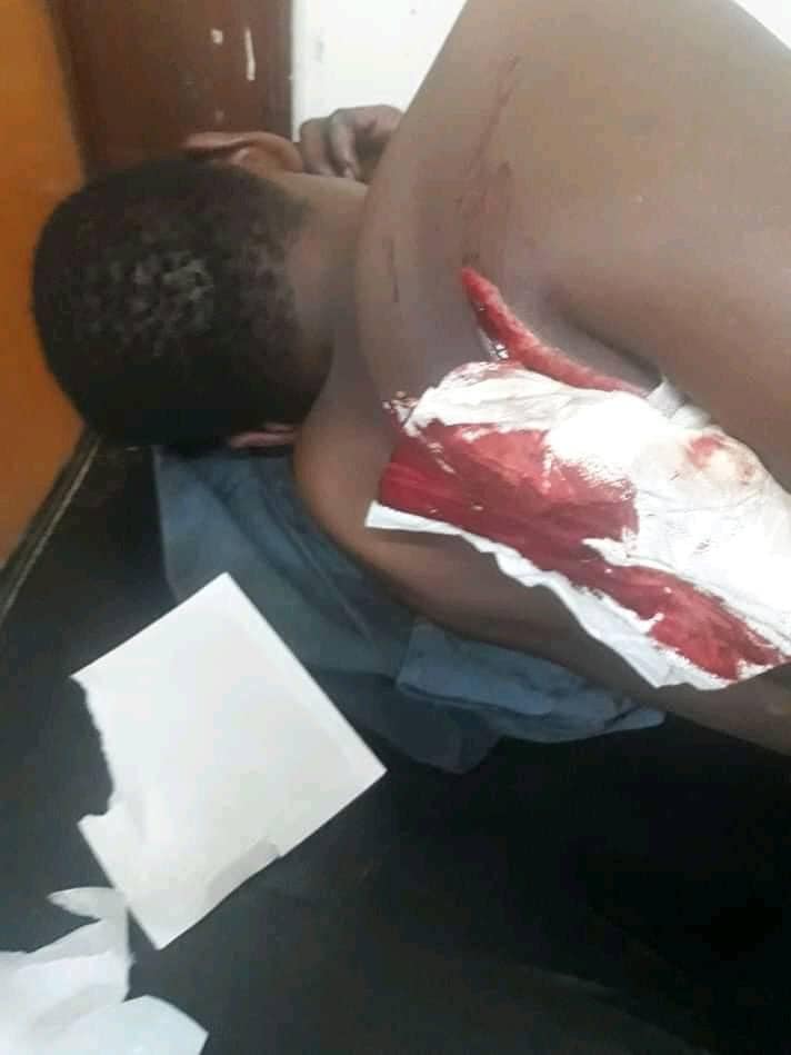 صورة الضحية بالمستشفى ، تم تداولها على شبكات التواصل الاجتماعي